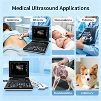 Appareil d'échographie vétérinaire portable Rayman avec sonde convexe/linéaire/rectale pour scanner les animaux gestants (bovins, chevaux)
