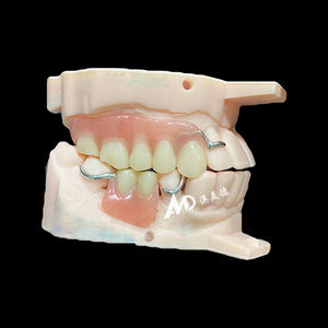 Protesi rimovibili personalizzate con struttura in metallo ripristinare la salute orale, facile da pulire, proteggere la pulizia orale - Product Image 2