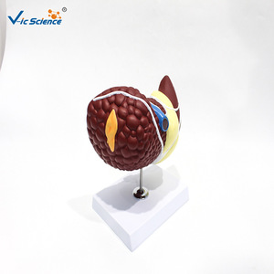 Modelo patológico de hígado humano; estructura cáncerica del hígado; herramienta de enseñanza y formación médica - Product Image 2