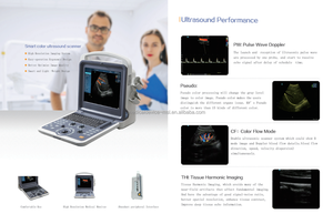 Aplicación clínica Led médica Ecografía Doppler de color portátil B/W Escáner de ultrasonido Máquina de ultrasonido - Product Image 4