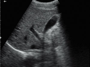 Mesin <span class=keywords><strong>Ultrasound</strong></span> dokter hewan Digital mingray DP-10Vet sistem <span class=keywords><strong>B</strong></span>/W - Product Image 6