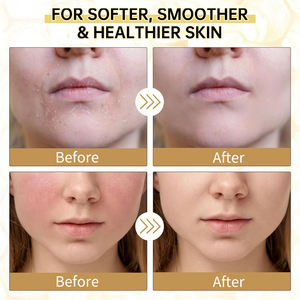 Peau sèche craquelée Baume hydratant pour suif multi-usage Baume pour soin de la peau du suif de boeuf Baume pour le suif - Product Image 3