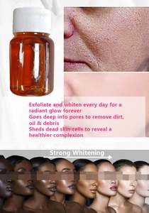 Suero Facial Control de Grasa y Reducción de Poros, Elimina <span class=keywords><strong>Manchas</strong></span> Oscuras, Mejora la Descamación, Suero con Vitamina B5, Solución Exfoliante con Logotipo B5, Cuidado de la Piel OEM - Product Image 2