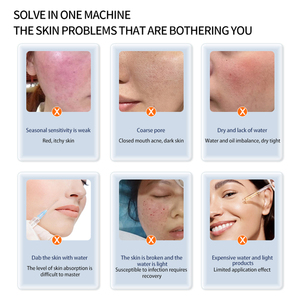 Appareil de soin du visage professionnel pour salon de beauté et spa, avec fonction vapeur, sauna, ozone et oxygène aqueux, à chaleur, Nouveauté - Product Image 4