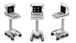 Échographe <span class=keywords><strong>Doppler</strong></span> Couleur Portable Numérique 3D/4D avec Écran 15 Pouces pour Hôpitaux - Product Image 4