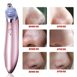 Aspirateur à points noirs rechargeable, aspirateur à pores <span class=keywords><strong>professionnel</strong></span>, <span class=keywords><strong>extracteur</strong></span> d'acné avec 4 têtes d'aspiration interchangeables - Product Image 6
