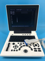 AMAIN Prêt à Expédier Chine Pas Cher Prix Image Claire 3D Portable Noir Blanc Machine à Ultrasons Humain Vétérinaire