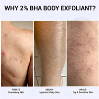Lotion corporelle exfoliante Oalen Private Label 2% BHA, affine la texture rugueuse, atténue les marques post-acnéiques pour les peaux du corps sujettes à la congestion cutanée