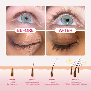 Klinischer Test Schnelle Verlängerung Private Label Lash Serum Wachstum Vegan Organic Enhancer <span class=keywords><strong>Peptide</strong></span> Wimpern wachstums seren mit Boxen - Product Image 3