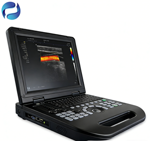 휴대용 컬러 도플러 초음파 진단기 의료기기 임신 진료용 초음파 장치 3년 보증 - Product Image 6