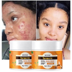 Tăng ánh nghệ thảo dược Mặt Kem làm trắng và loại bỏ mụn trứng cá mụn mặt chống mụn Kem - Product Image 4