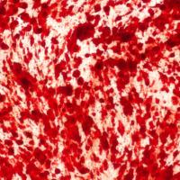 Kit de Tinción de Nódulos Mineralizados Osteoblasticos de Alta Calidad Solarbio (Método Alizarin Red S) para Investigación Científica