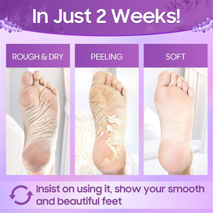 Mascarilla Exfoliante para Pies con Lavanda y Vitamina C, 40g, Previene la Resequedad, Suaviza la Cutícula, Venta al Por Mayor - Product Image 2