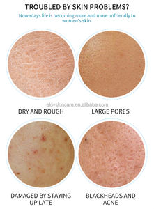 Natürlicher Extrakt Hyaluron säure Gesichts maske Starke feuchtigkeit spendende Poren schrumpfende Schönheit Gesichts pflege Maske Blatt Pflege für Unisex - Product Image 3