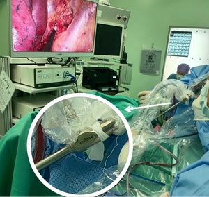 Endoscopio rígido UHD de 10x450mm, aparoscopio autoclavable de 0 30 grados, laparoscopio con CE para cámara endoscópica, instrumento quirúrgico - Product Image 5