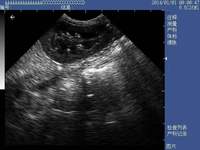 Échographe vétérinaire portable de type tablette, entièrement numérique, pour animaux de compagnie et bétail, avec fonction de diagnostic de gestation et Wi-Fi