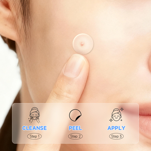 Microneedle Pimple Patch Private Label Verpakking Aangepaste Acne Behandeling Rijk aan Diverse Actieve Ingrediënten Efficiënte Reparatie - Product Image 4