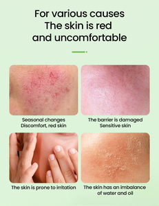 <span class=keywords><strong>S</strong></span>érum réparateur Cica pour le visage à la Centella Asiatica, léger, pour apaiser les peaux sensibles, réduire les rougeurs, soin de la peau - Product Image 3