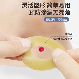 Anillo a prueba de fugas de grado médico, parche hidrocoloide moldeable a prueba de fugas, bolsa de ostomía, cuidado de la bolsa de ostomía de drenaje rectal. - Product Image 2
