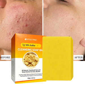 <strong>Wholesale</strong> Face Body Care Handmade Skin Whitening Brightening Dark Spot Remover Solid Original 10% <strong>Sulfur</strong> Cleansing Soap <strong>Bar</strong> - Product Image 2