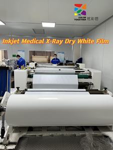 Analisis perbandingan sistem Digital dan Film sinar X konvensional - Product Image 3