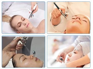 Máquina de Limpieza Facial con Oxígeno, Hidratación y Limpieza de Poros con Chorro de Oxígeno a Alta Presión - Product Image 5