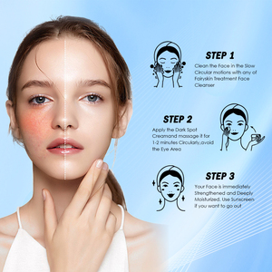 Venta caliente Anti Acné Crema <span class=keywords><strong>para</strong></span> eliminar espinillas <span class=keywords><strong>para</strong></span> todo tipo de piel Anti <span class=keywords><strong>Manchas</strong></span> Venta al por mayor Anti Acné Crema facial - Product Image 5