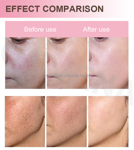 <span class=keywords><strong>Meilleure</strong></span> Lotion blanchissante pour la peau, <span class=keywords><strong>crème</strong></span> blanchissante pour la peau noire - Product Image 5