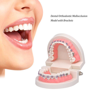 Modelo Dental Portátil de PVC para Enseñanza de Ortodoncia con Aparatos Ortodóncicos - Product Image 3