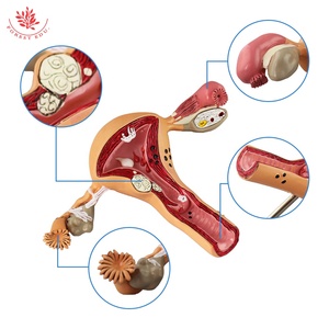 Modello utero organi riproduttivi femminili anatomia struttura patologica educazione anatomica - Product Image 5