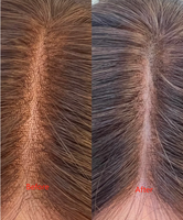En gros : Stylo de masquage pour dentelle, outils pour la dentelle visible des perruques en cheveux naturels, stylo de coloration pour la dentelle, craie pour la démarcation de la dentelle