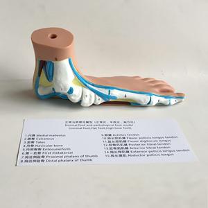 Podiatri Öğretimi için 3 Çeşit Ayak Kemeri Anatomisi Modeli Normal Düz ve Yüksek Kemerli Ayaklar - Product Image 4