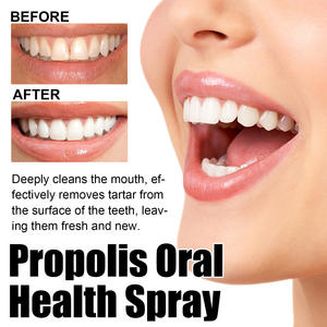 ORALHOE 20ml Nettoie les taches et la plaque dentaire Blanchit les dents Élimine les odeurs Rafraîchit l'haleine <span class=keywords><strong>Spray</strong></span> buccal à la <span class=keywords><strong>propolis</strong></span> <span class=keywords><strong>verte</strong></span> pour femmes Utilisation à domicile - Product Image 4