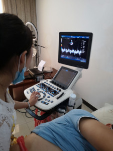 Siêu âm xách tay Thiết bị chẩn đoán tim mạch máu siêu âm DOPPLER màu Echo máy siêu âm - Product Image 2