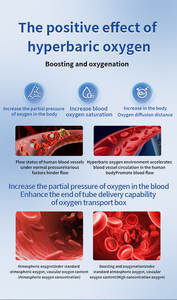 2.0ATA All-in-One hyperbare zuurstoftherapie (HBOT) machine voor 1 persoon, met luchtcompressor, koeling en zuurstofproductie voor thuisgebruik - Product Image 5