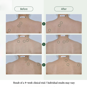 Etrun Alisa nhãn hiệu riêng cơ thể <span class=keywords><strong>Mist</strong></span> phun nhẹ nhàng sửa chữa da dưỡng ẩm làm dịu PH cân bằng chăm sóc da cho phụ nữ - Product Image 2