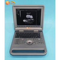 Système de diagnostic échographique numérique complet SUN-806A à bas prix, basé sur PC, noir et blanc, avec écran 12,1 pouces
