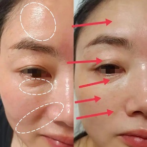 <span class=keywords><strong>Crema</strong></span> Terapeutica <span class=keywords><strong>Bio</strong></span>-Microneedling con Cellule Staminali, Esosomi, Spongilla, Alghe e Spicule per il <span class=keywords><strong>Viso</strong></span> - Anti-Rughe - Product Image 2