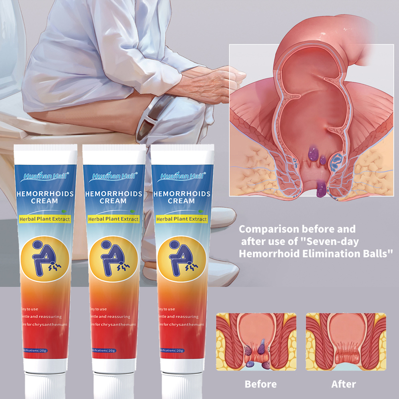 20g Natural Herbal Hemorrhoid Ointment Mild