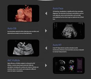 स्कैनर ट्रॉली गूफो अल्ट्रासाउंड मशीन/सोनोस्कैप पी 9 कुलीन 5 डी अल्ट्रासाउंड नैदानिक तनाव इको - Product Image 5