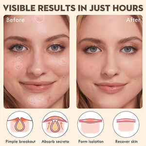 OEM 2% ácido salicílico 144 acné curación espinillas parche Invisible hidrocoloide cubierta pegatina para cara - Product Image 6