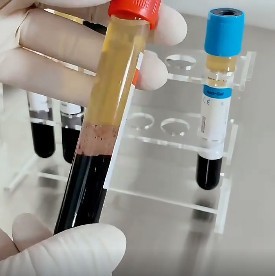 Kit PRP di Alta Qualità OEM 8-15mL in <span class=keywords><strong>Vetro</strong></span> o Plastica, Tubo Sterile per Gel Rapido, per Recupero Lesioni Tendini Equini e Canini - Product Image 2