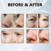 Équipement de beauté pour le soin du visage, jet d'eau pour le nettoyage du visage, peeling, spa, OEM/ODM, plusieurs fonctions 6 en 1