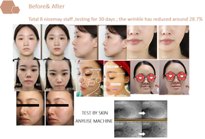 Home Use Microcurrent Anti-Aging Face <strong>Massager</strong> <strong>Facial</strong> Lifting Device for Skin Tightening Standing Type - Product Image 6