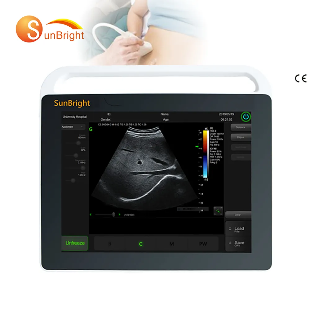 Pemindai diagnostik tubuh ultrasonik SUN-800S, peralatan Ultrasound portabel