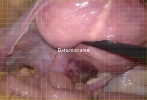 Système de caméra d'endoscopie vidéo médicale Mindray série UX1 haute résolution pour usage vétérinaire - Product Image 5