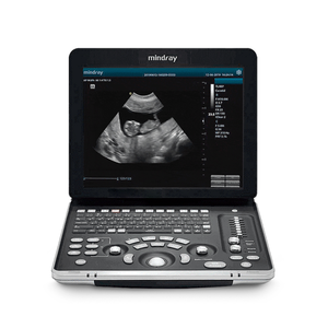 Mingray mesin <span class=keywords><strong>Ultrasound</strong></span> dokter hewan, hitam dan putih DP50Vet dengan <span class=keywords><strong>65C15EA</strong></span> <span class=keywords><strong>Probe</strong></span> mikroconvex dalam stok - Product Image 1