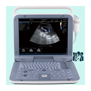 Escáner de Ultrasonido <span class=keywords><strong>Doppler</strong></span> Multifuncional Personalizable Directo de Fábrica con Funciones de Prueba Cardíaca, Ginecológica y de Embarazo - Product Image 2