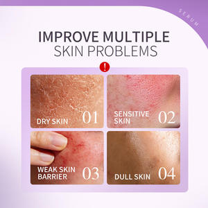 Crema Facial Reparadora de Barrera Cutánea para Piel Sensible/Seca, Hidratación Profunda, Calmante y Fortalecedora de la Defensa Cutánea - Product Image 4