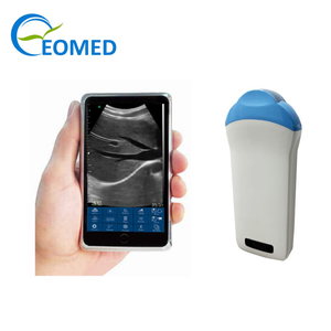 <span class=keywords><strong>Sonde</strong></span> d'échographie sans fil micro-convexe, mode B, appareil d'échographie <span class=keywords><strong>portable</strong></span>, compatible Android, iOS, Windows, BW15 - Product Image 1